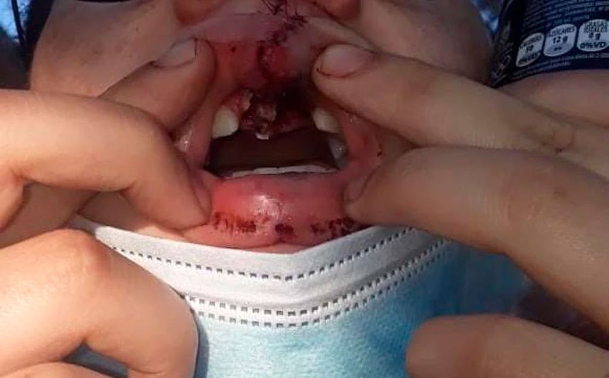 Denuncian abuso policial en Córdoba: a una joven le sacaron los dientes