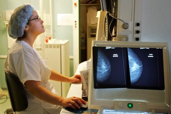 Diagnostican más de 5.000 casos de cáncer por año en Mendoza