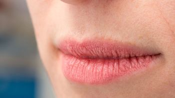 Cómo cuidar tus labios en invierno para que no se resequen Cómo cuidar tus labios en invierno para que no se resequen