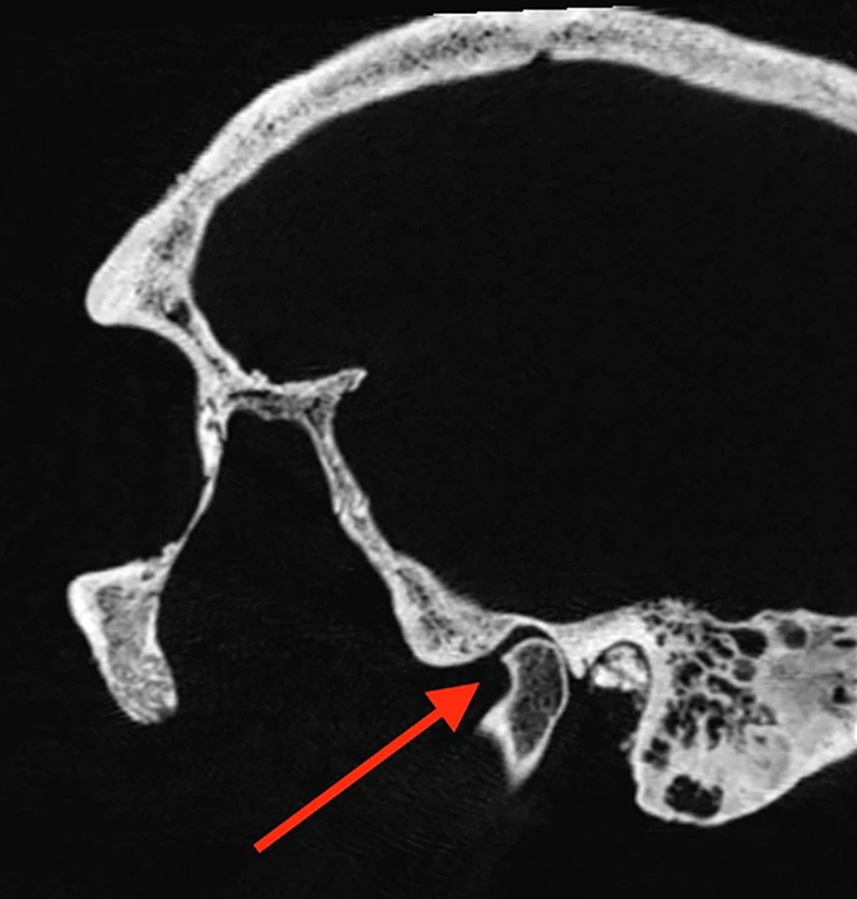 Los investigadores encontraron diversas lesiones en los cuerpos. Los investigadores encontraron diversas lesiones en los cuerpos.
