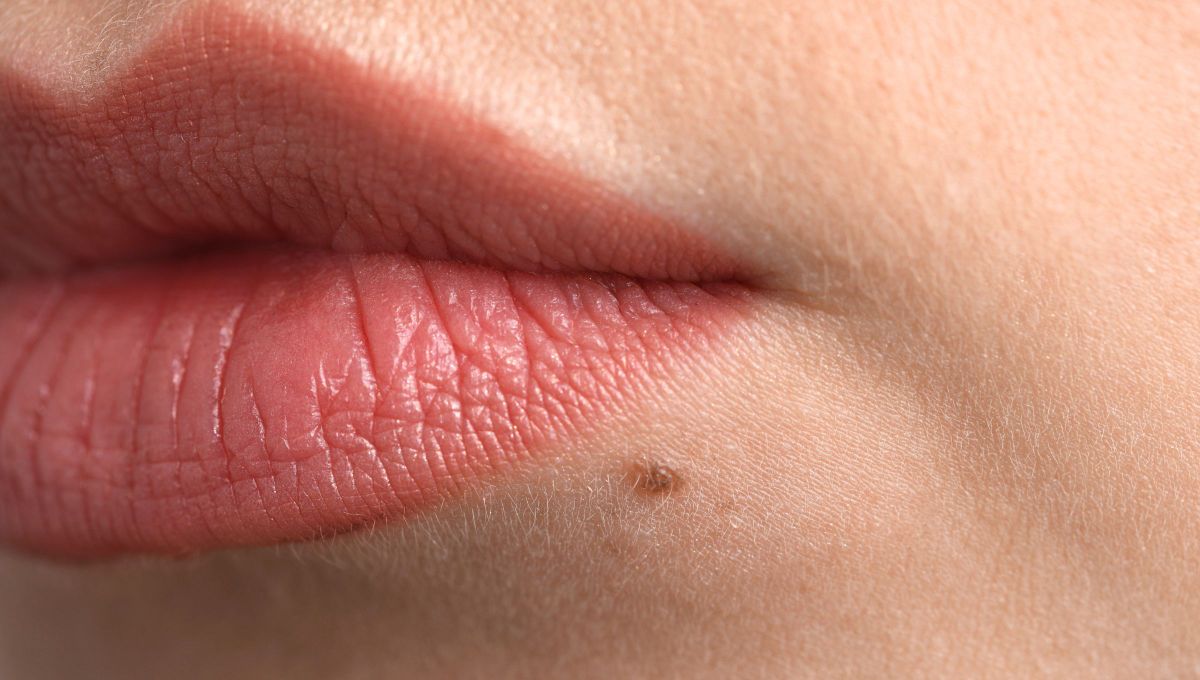 Qué significa tener un lunar en la cara o en el cuello