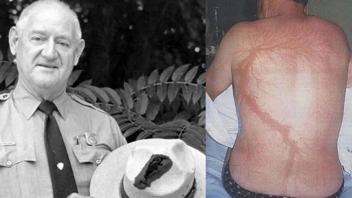 Entre 1942 y 1977, este hombre sobrevivió 7 veces al impacto de un rayo. Entre 1942 y 1977, este hombre sobrevivió 7 veces al impacto de un rayo. 