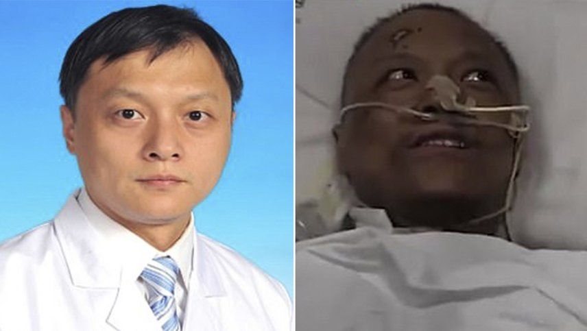 Murió el médico chino al que le cambió el color de piel producto del coronavirus