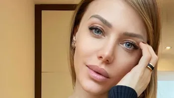 Preocupación por el impactante tratamiento estético al que se sometió Evangelina Anderson Preocupación por el impactante tratamiento estético al que se sometió Evangelina Anderson