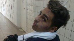 Dos soldados voluntarios  hirieron a golpes a un joven a la salida de un boliche