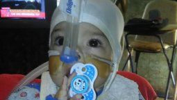 El pequeño Itan necesita la donación de una leche especial para vivir