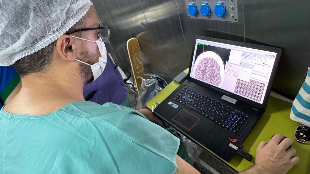 La nueva tecnología en materia de neurocirugía al servicio de la comunidad en el hospital Lagomaggiore La nueva tecnología en materia de neurocirugía al servicio de la comunidad en el hospital Lagomaggiore