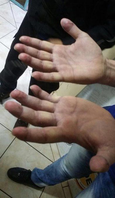 Pérez Corradi pagó 50 mil dólares para borrarse las huellas dactilares
