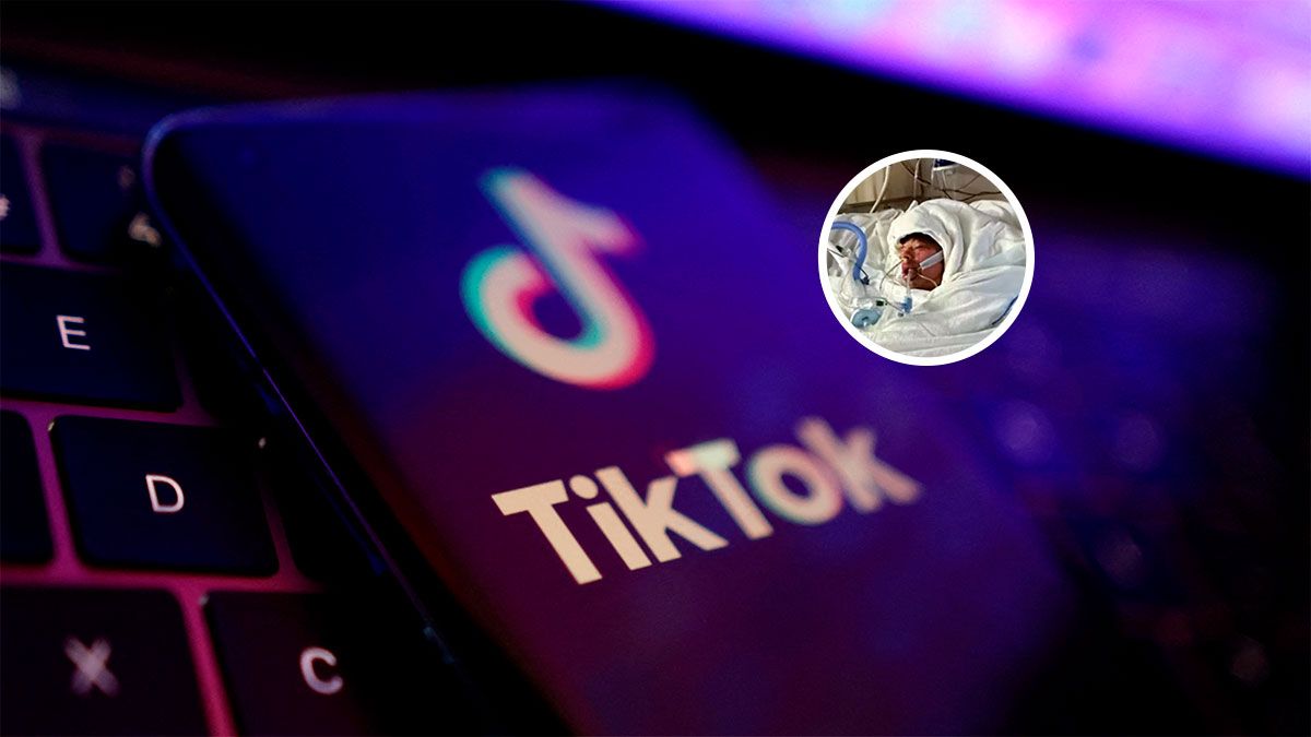 Intentó cumplir un desafío de TikTok y terminó con quemaduras en el 80% de su cuerpo.