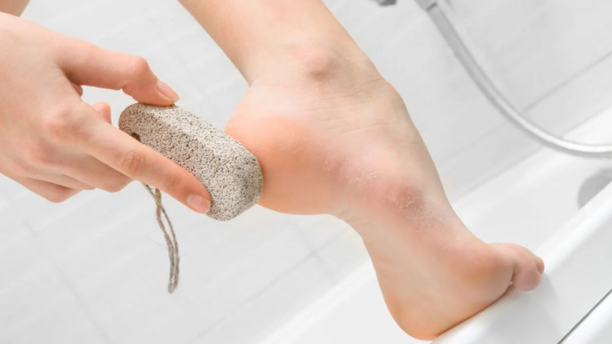 La piedra pómez es el elemento perfecto para curar los pies agrietados.