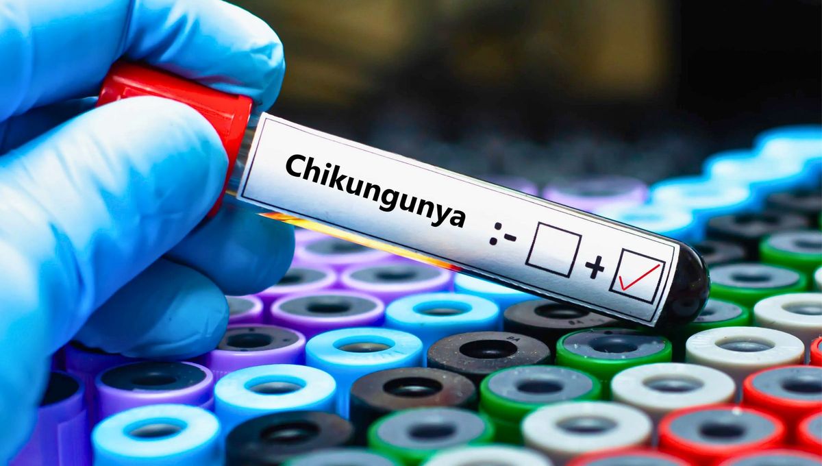 Un día como hoy, científicos han desarrollado una nueva vacuna Un día como hoy, científicos han desarrollado una nueva vacuna