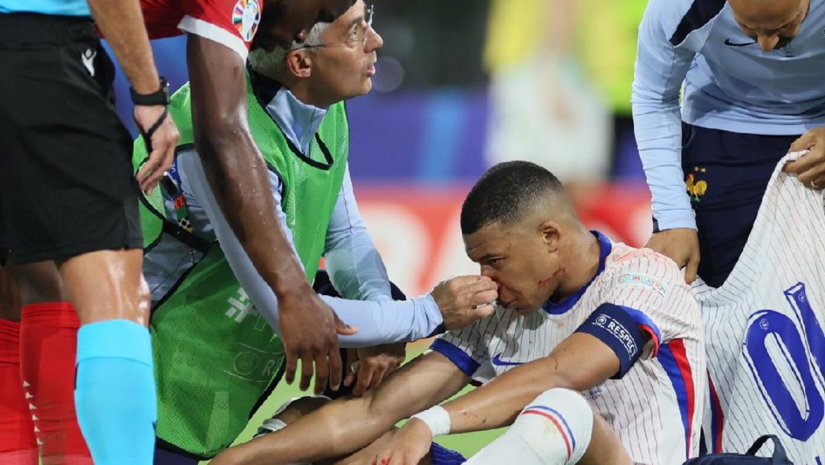 Mbappé intentó ingresar a la cancha luego de ser atendido por su lesión, pero se dejó caer de inmediato, conmocionado por el golpe y la gravedad de la fractura del tabique nasal. Mbappé intentó ingresar a la cancha luego de ser atendido por su lesión, pero se dejó caer de inmediato, conmocionado por el golpe y la gravedad de la fractura del tabique nasal.