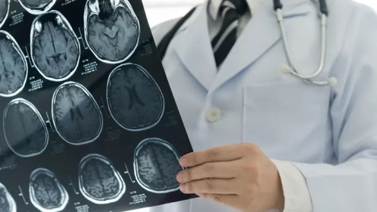 ¿Cuándo se debe visitar al neurólogo? Algunas señales puden alertar sobre una grave afección