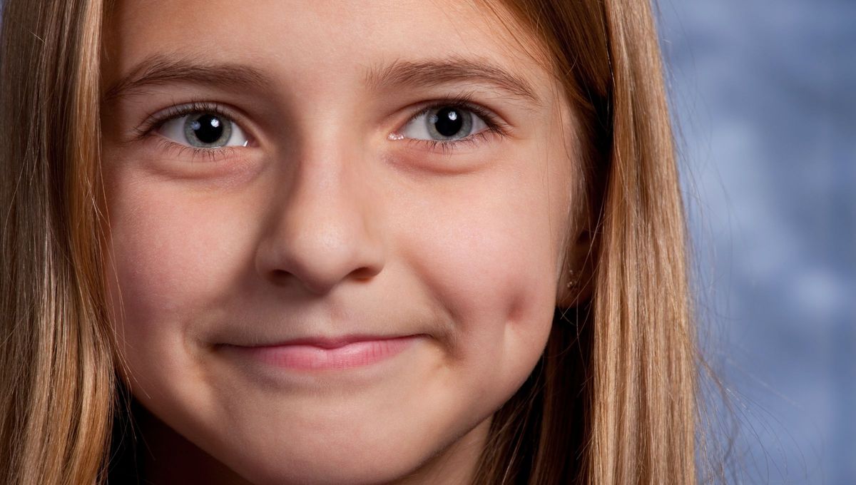 Los hoyuelos son peque&ntilde;as hendiduras que aparecen en las mejillas y que a menudo se hacen m&aacute;s notorias cuando una persona sonr&iacute;e.