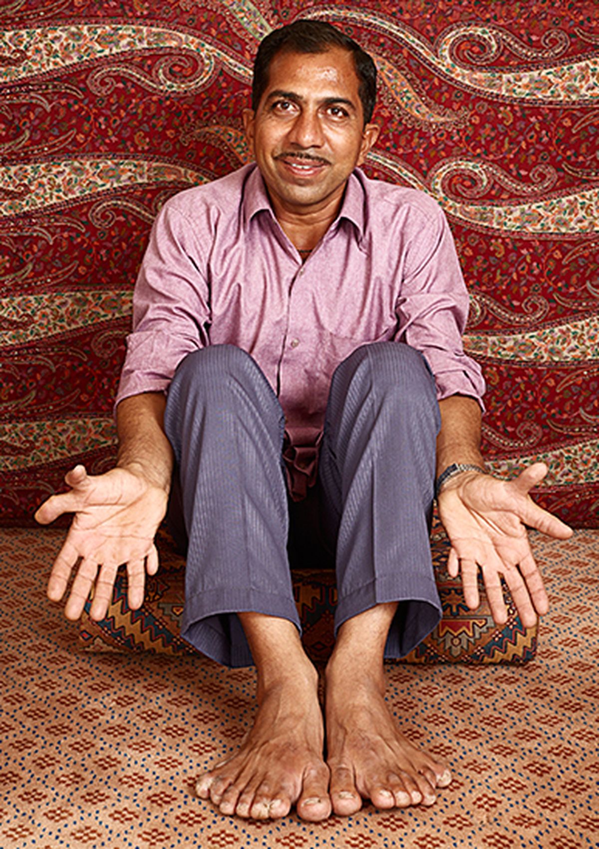 Devendra Suthar, el carpintero con 28 dedos. Devendra Suthar, el carpintero con 28 dedos.