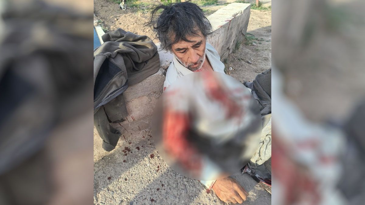 Dos perros pitbull atacaron brutalmente a un hombre que entraba a trabajar a un galpón de ajo