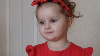 Una niña de 3 años murió por una severa infestación de piojos y sus padres fueron condenados Una niña de 3 años murió por una severa infestación de piojos y sus padres fueron condenados