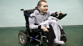 La harán el primer transplante de cabeza para salvarle la vida