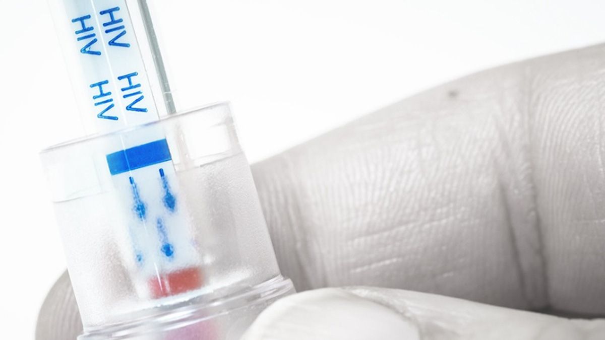 Este martes se celebra el Día de la Prueba del HIV. El porcentaje de personas que desconocen su condición en la Argentina bajó en los últimos 10 años Este martes se celebra el Día de la Prueba del HIV. El porcentaje de personas que desconocen su condición en la Argentina bajó en los últimos 10 años