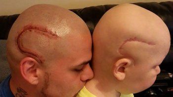 Murió el niño cuyo padre se tatuó una cicatriz como la suya para ayudarlo en su lucha contra el cáncer
