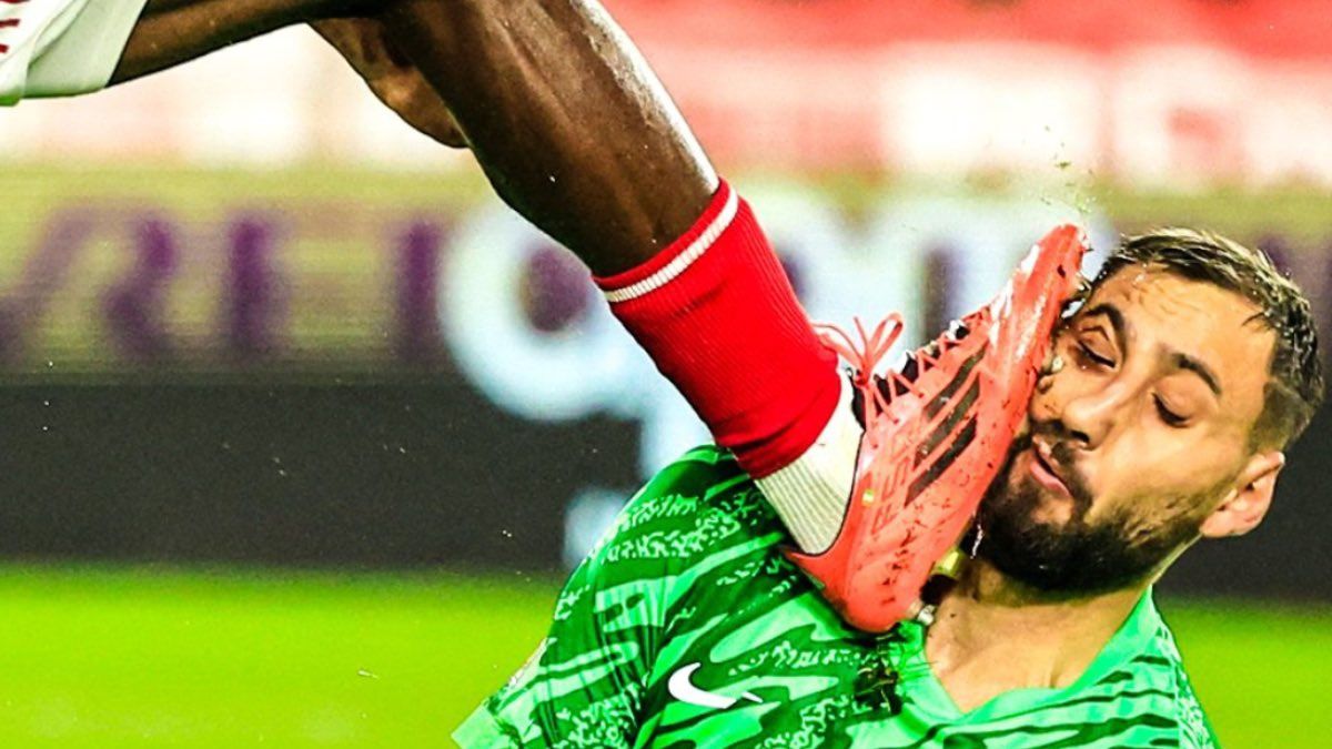Gianluigi Donnarumma recibió un gran golpe en su rostro.
