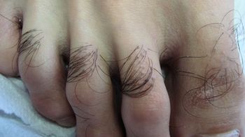 Ni higiene, ni estética: la sorprendente conexión entre los pelos de los pies y tu salud