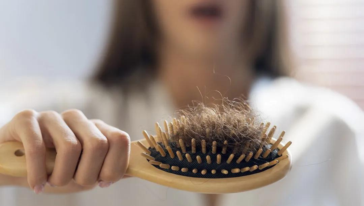 Qué alimentos son los que ayudan a combatir la caída del cabello Qué alimentos son los que ayudan a combatir la caída del cabello