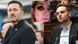 El ministro de Defensa de la Nación, Luis Petri, y el senador provincial Gabriel Pradines, fueron algunas de las figuras políticas mendocinas que repudiaron las imágenes de Fabiola Yañez golpeada.