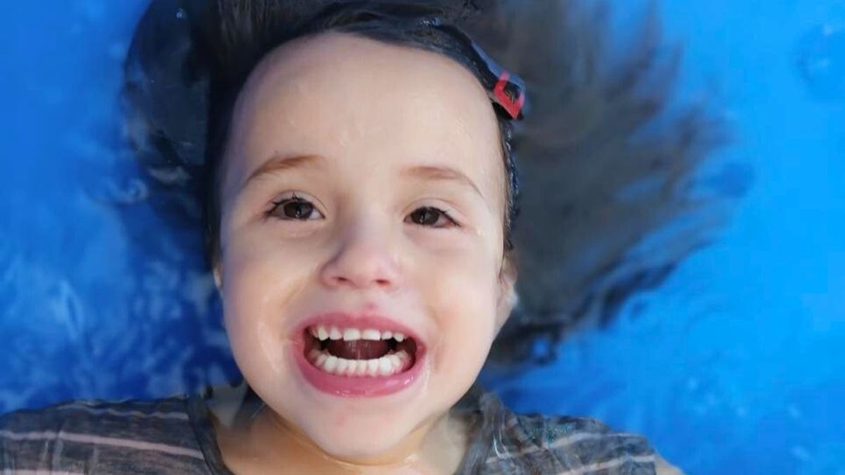 Se calcula que en Mendoza 20 niñas tienen Síndrome de Rett. Se calcula que en Mendoza 20 niñas tienen Síndrome de Rett.