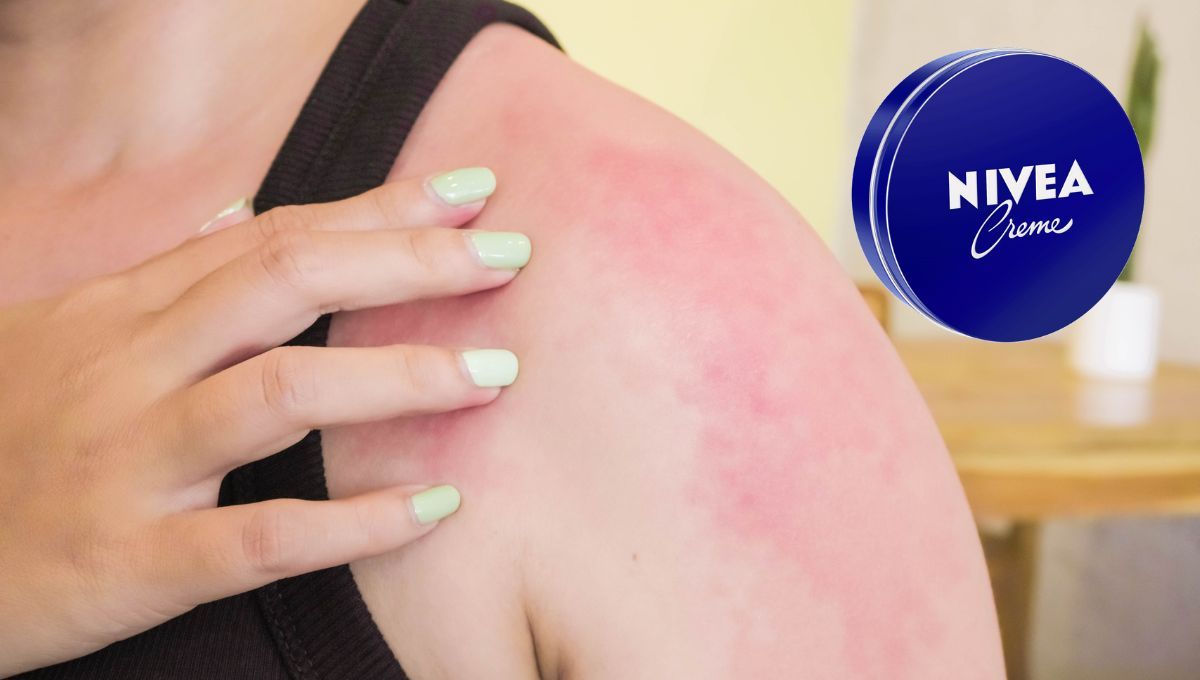 ¿Qué enfermedades se pueden combatir con la crema Nivea azul?