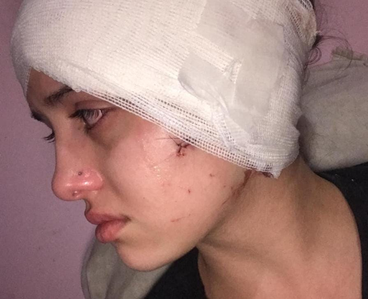 Agustina, la moza de la calle Arístides que fue atacada.