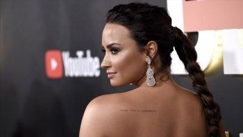 El antes y el después de Demi Lovato que es furor en Instagram