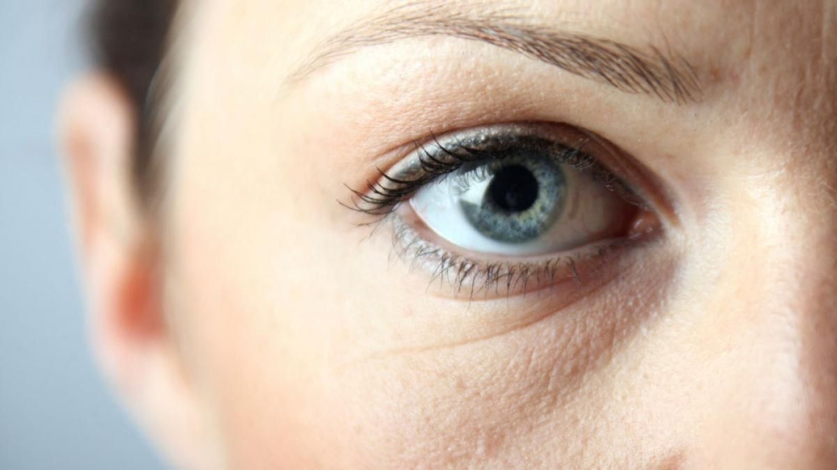 Trucos de belleza: cómo eliminar las ojetas con 1 ingrediente de cocina.