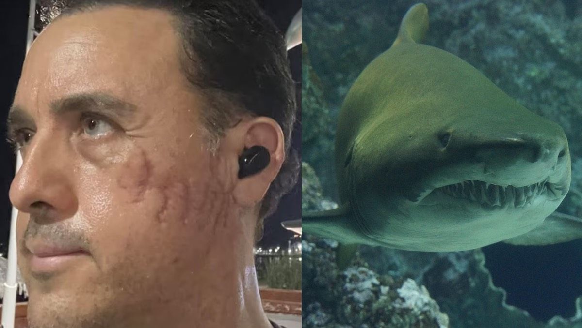 Milagro. Un reconocido biólogo mexicano fue mordido por un tiburón en su cara. Milagro. Un reconocido biólogo mexicano fue mordido por un tiburón en su cara.