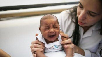 EEUU: nacieron dos bebés en California con microcefalia asociada al zika