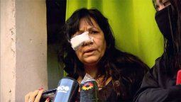 En el barrio porteño de Villa Lugano una mujer denunció ser apuñalada en la cara como represalia por haber denunciado a los narcos que venden en esa zona.&nbsp; 