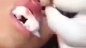 Sentía dolor en el labio y le sacaron un gusano