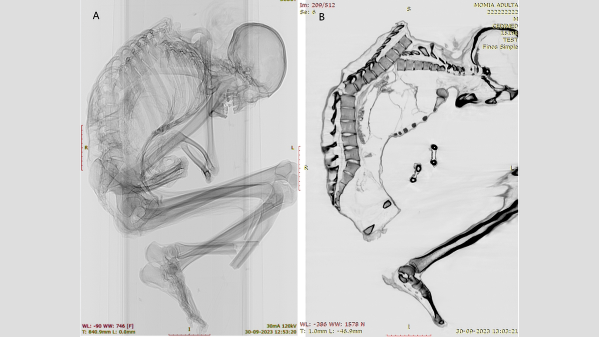 Descubrimiento en Chile revela la grotesca muerte de una momia de hace mil años