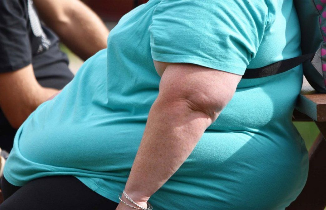 La Sociedad Argentina de Nutrición pide que la obesidad sea tratada como una enfermedad. 