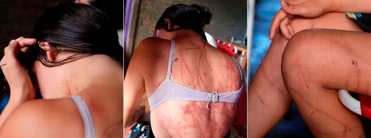 La joven de 17 años contó que su pareja la agredió físicamente y la violó con una madera.