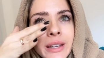 La China Suárez tuvo un accidente y se quemó parte de su cuerpo: la foto La China Suárez tuvo un accidente y se quemó parte de su cuerpo: la foto