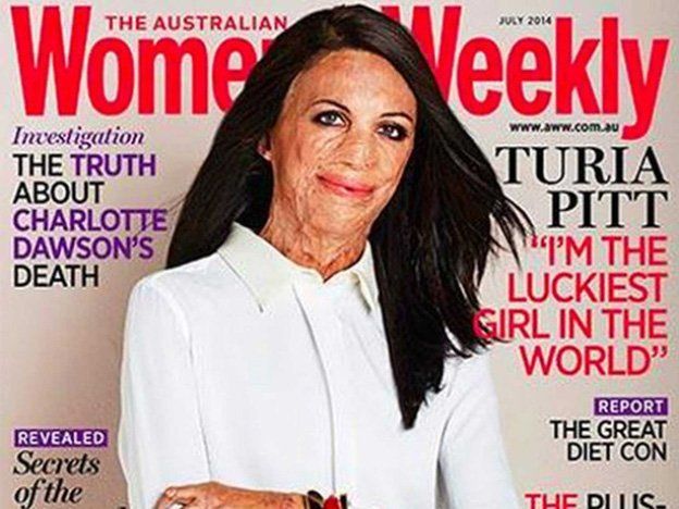 Sobrevivió a un incendio y ahora fue portada de una revista de moda
