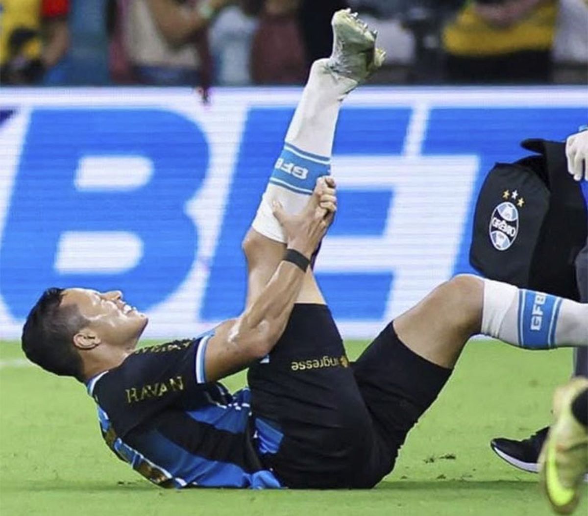 Es tremenda la foto de Marlon, que sufri&oacute; una grave lesi&oacute;n.