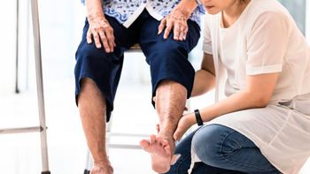 Ni nadar, ni andar en bicicleta: el ejercicio que previene las várices en los adultos mayores Ni nadar, ni andar en bicicleta: el ejercicio que previene las várices en los adultos mayores