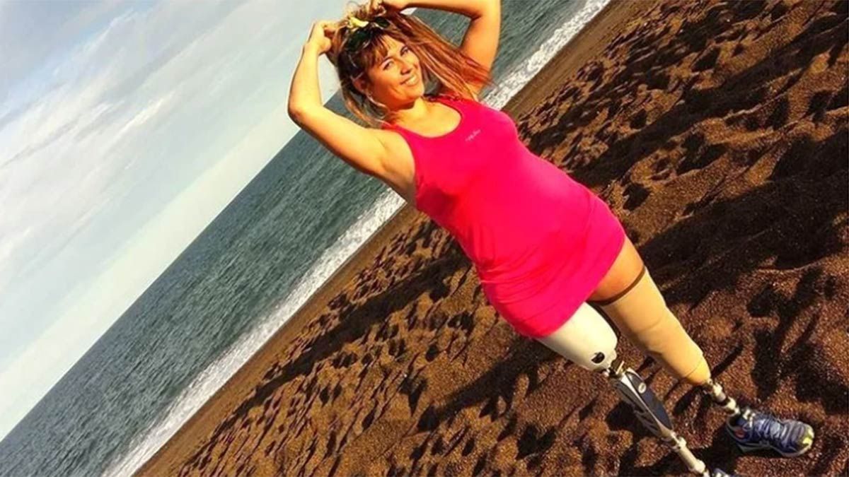 Liliana Méndez perdió las piernas en un accidente, pero siguió adelante con su vida.&nbsp;