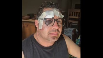 Iba en moto, cayó en un pozo y lo taparon con una sábana porque pensaron que estaba muerto