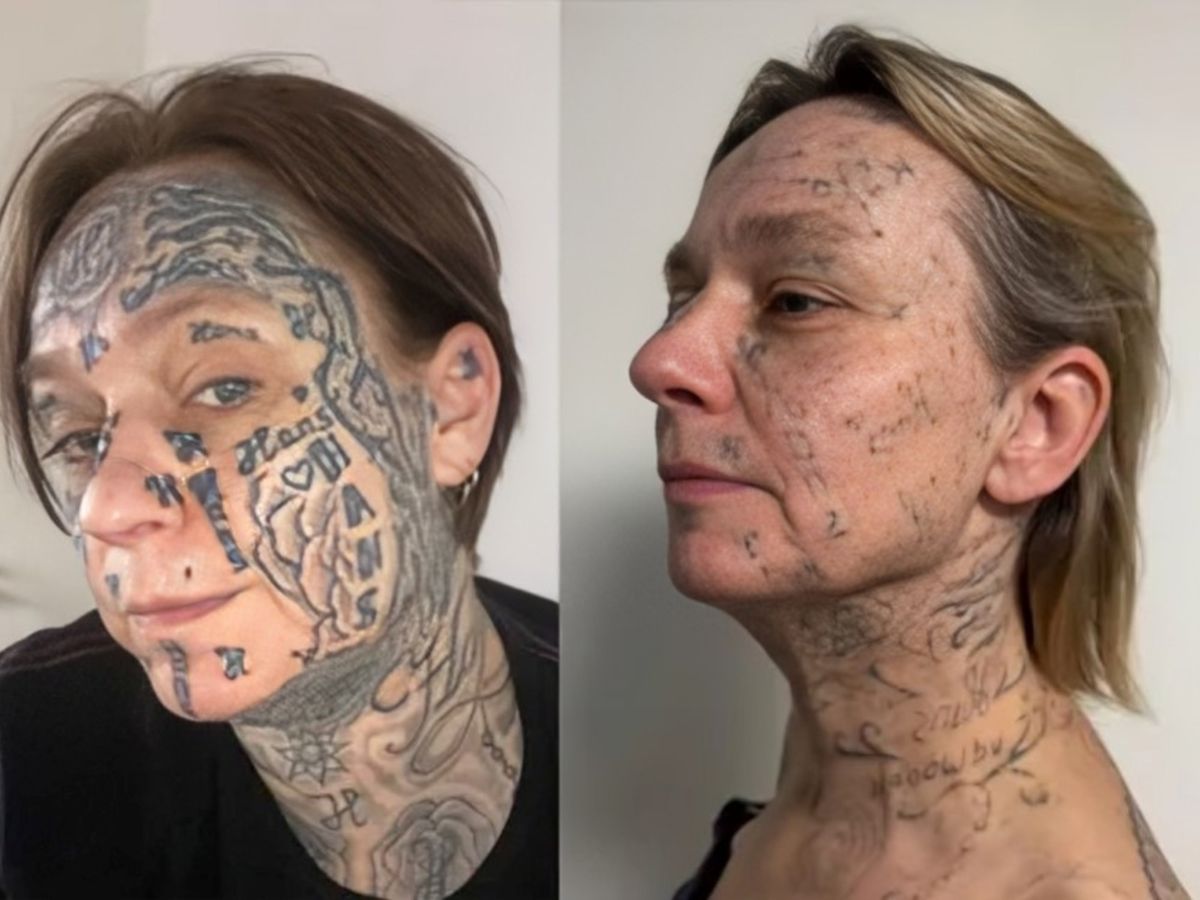 Poco a poco, la mujer comienza a recuperar su vida normal. Poco a poco, la mujer comienza a recuperar su vida normal. 