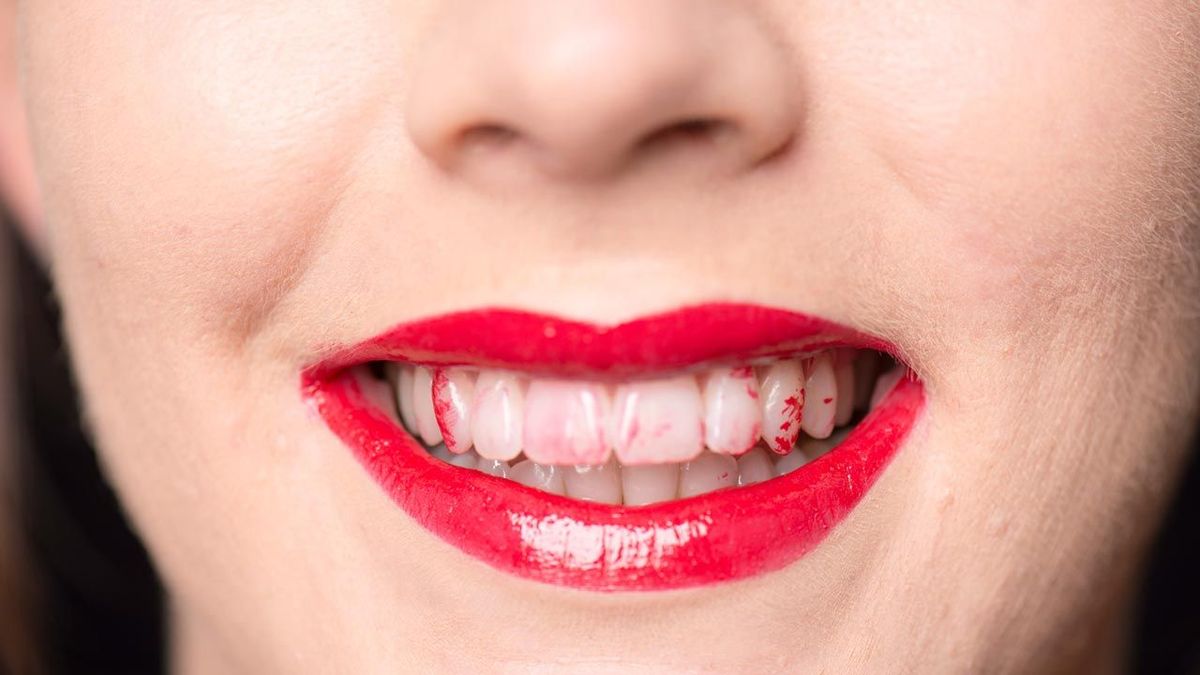 Manchas de labial en los dientes. Manchas de labial en los dientes.
