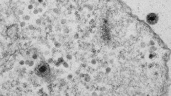 Descubrieron en Brasil un misterioso virus que desconcierta a los científicos
