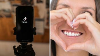 Cuáles son los peligros de los remedios caseros de TikTok para blanquear los dientes, según una especialista Cuáles son los peligros de los remedios caseros de TikTok para blanquear los dientes, según una especialista